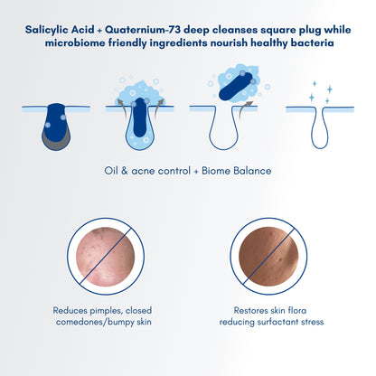 Becalm Airy Salicylic Acid Face Wash For Oily Skin